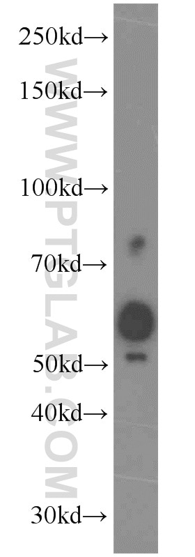 Western Blot (WB) analysis of mouse testis tissue using SPO11 Polyclonal antibody (15509-1-AP)
