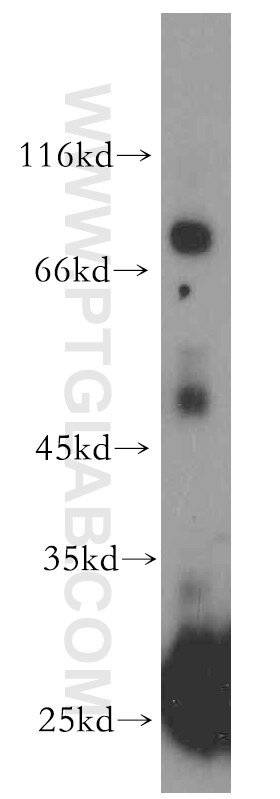 Western Blot (WB) analysis of human testis tissue using SPO11 Polyclonal antibody (15509-1-AP)