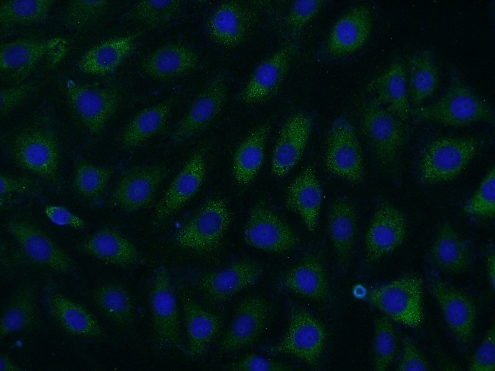Immunofluorescence (IF) / fluorescent staining of SH-SY5Y cells using SPOCD1 Polyclonal antibody (22243-1-AP)