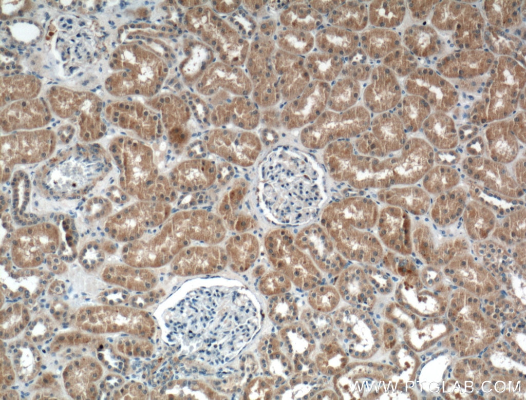 Immunohistochemistry (IHC) staining of human kidney tissue using SPOCD1 Polyclonal antibody (22243-1-AP)