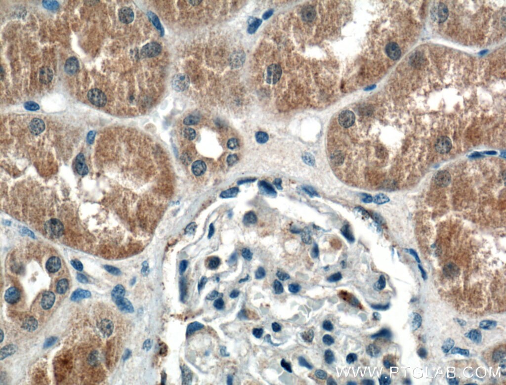 Immunohistochemistry (IHC) staining of human kidney tissue using SPOCD1 Polyclonal antibody (22243-1-AP)