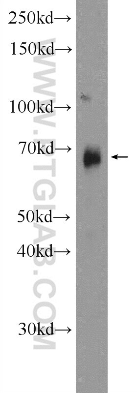 Western Blot (WB) analysis of human testis tissue using SPOCD1 Polyclonal antibody (22243-1-AP)