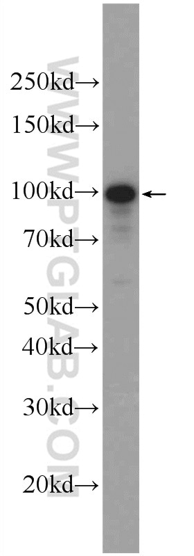 Western Blot (WB) analysis of SH-SY5Y cells using SPOCD1 Polyclonal antibody (22243-1-AP)