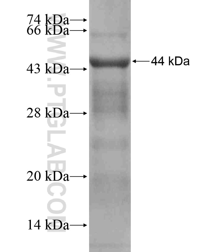 SPOCD1 fusion protein Ag17734 SDS-PAGE