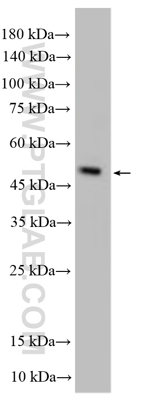 Western Blot (WB) analysis of various lysates using SPOCK1 Polyclonal antibody (28203-1-AP)
