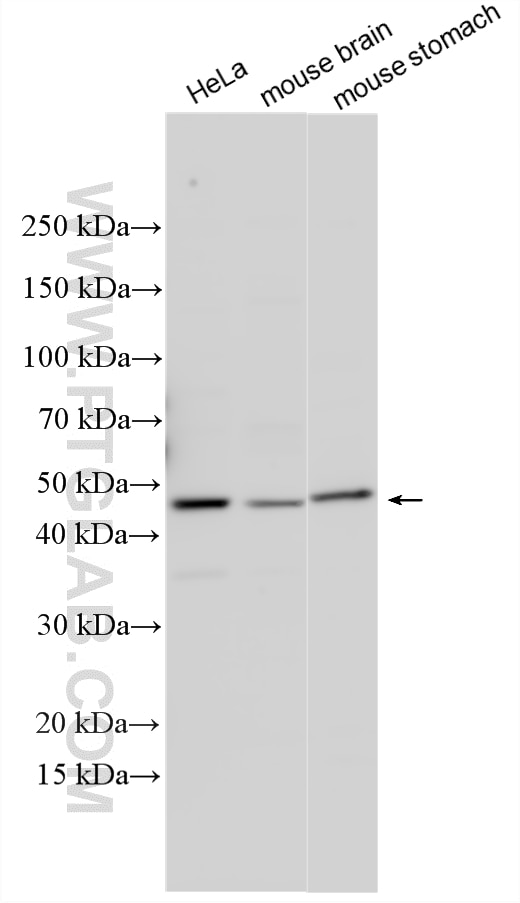 Western Blot (WB) analysis of various lysates using SPOCK1 Polyclonal antibody (28203-1-AP)