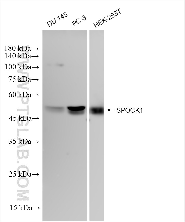 Western Blot (WB) analysis of various lysates using SPOCK1 Recombinant antibody (84977-1-RR)