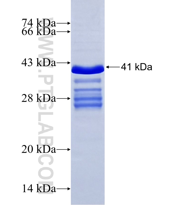 SPOCK1 fusion protein Ag28204 SDS-PAGE