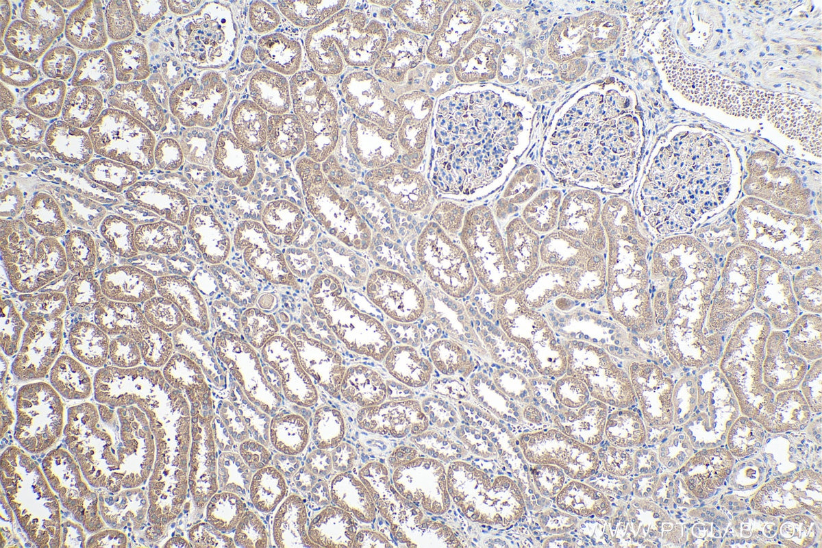 Immunohistochemistry (IHC) staining of human kidney tissue using SPOCK2 Polyclonal antibody (11725-1-AP)