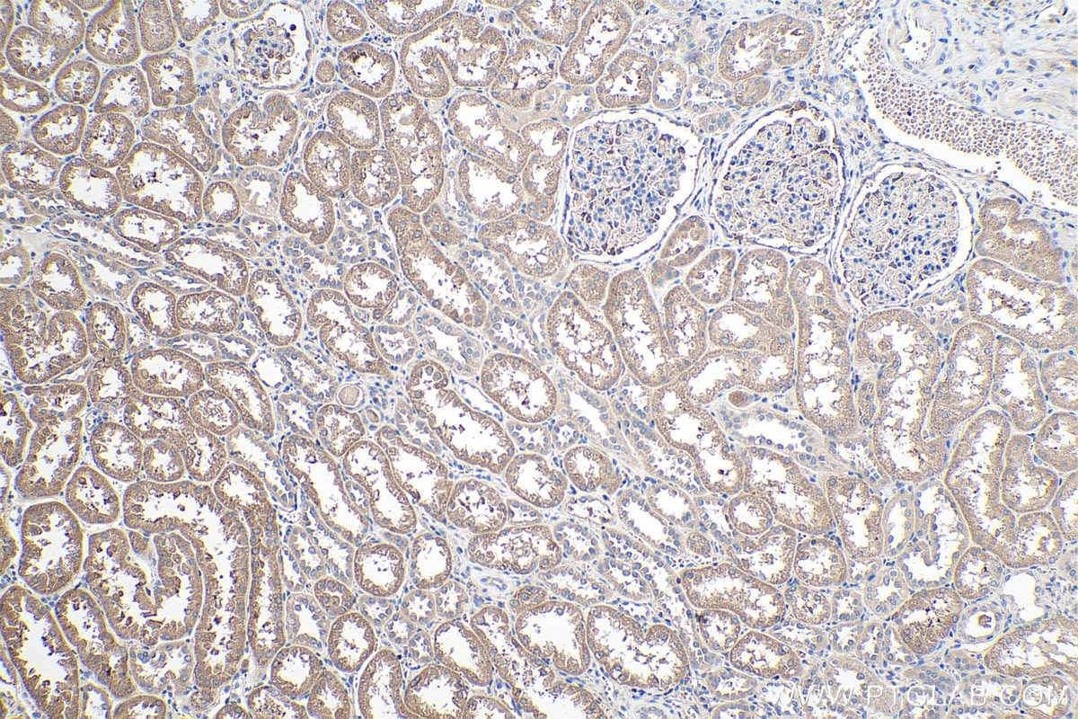 IHC staining of human kidney using 11725-1-AP