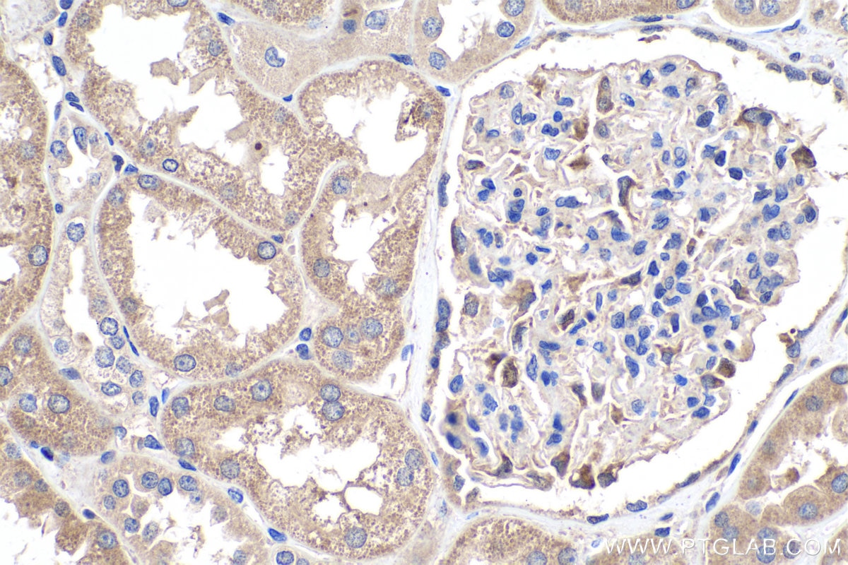 IHC staining of human kidney using 11725-1-AP