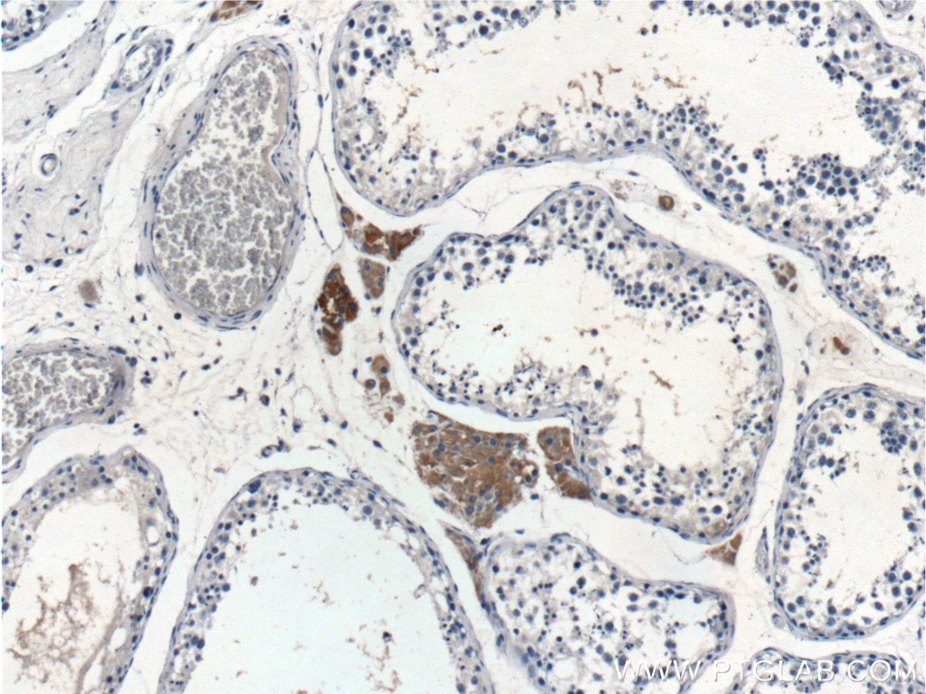 Immunohistochemistry (IHC) staining of human testis tissue using SPOCK2 Polyclonal antibody (11725-1-AP)