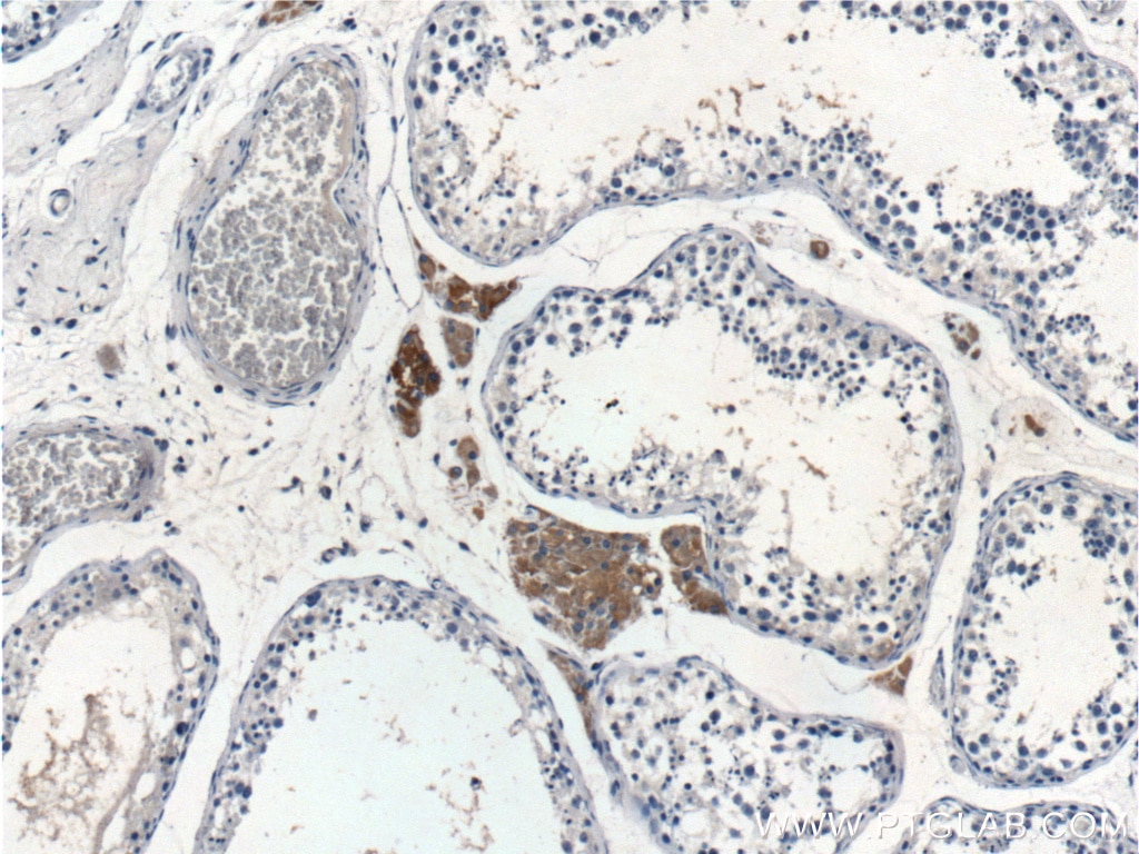 IHC staining of human testis using 11725-1-AP