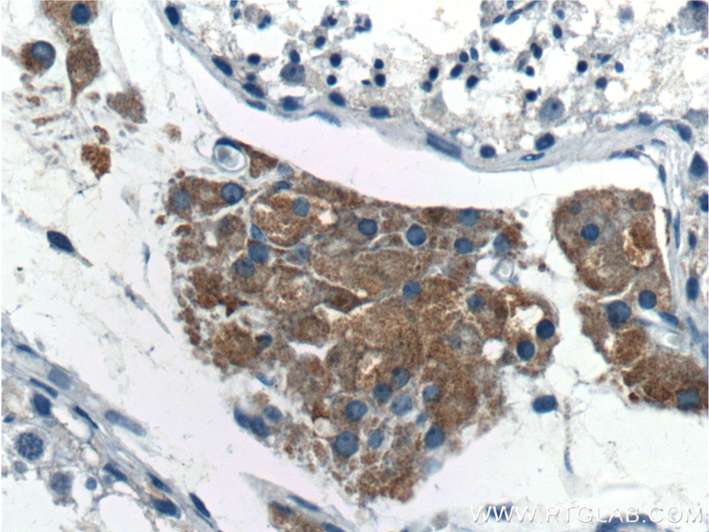 Immunohistochemistry (IHC) staining of human testis tissue using SPOCK2 Polyclonal antibody (11725-1-AP)