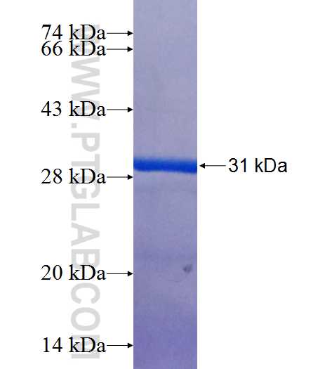 SPOCK2 fusion protein Ag25875 SDS-PAGE