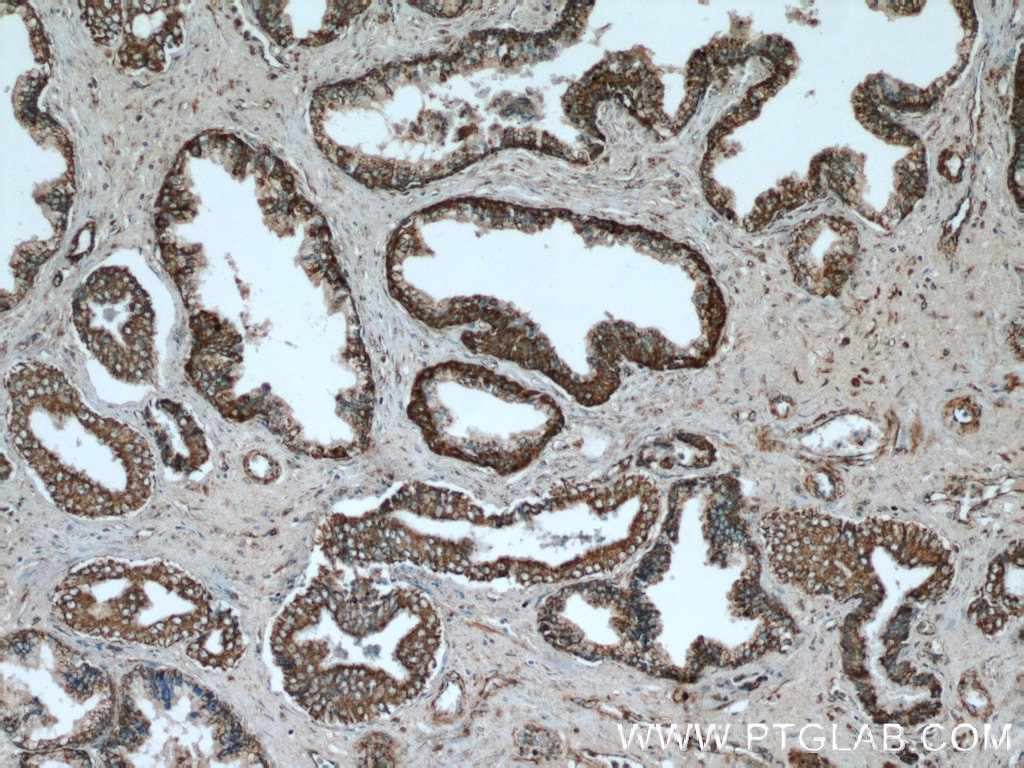 Immunohistochemistry (IHC) staining of human prostate hyperplasia tissue using SPON2 Polyclonal antibody (20513-1-AP)