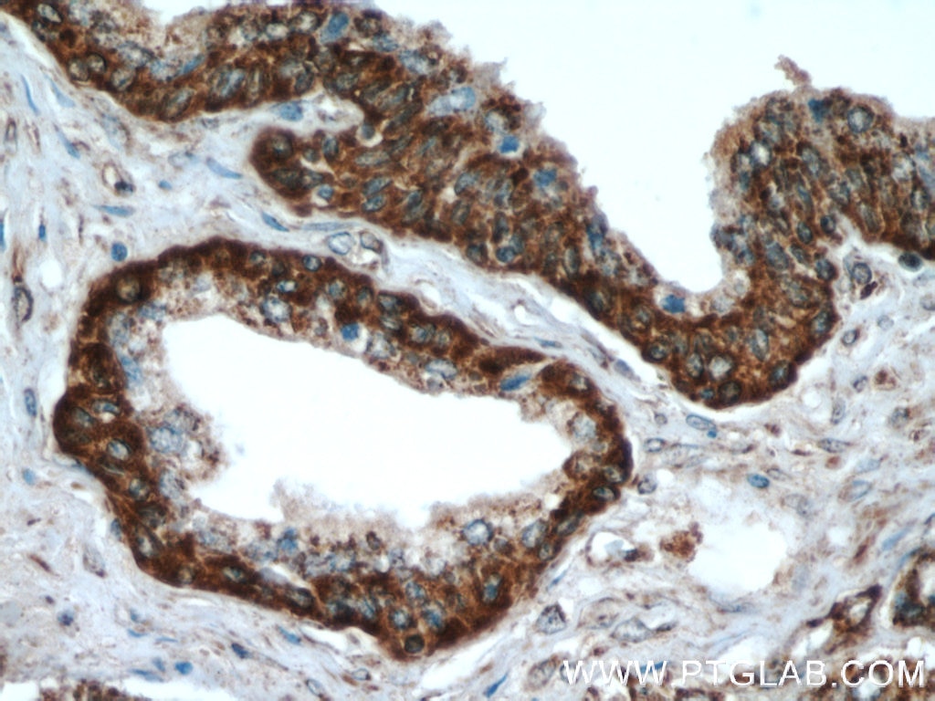 Immunohistochemistry (IHC) staining of human prostate hyperplasia tissue using SPON2 Polyclonal antibody (20513-1-AP)