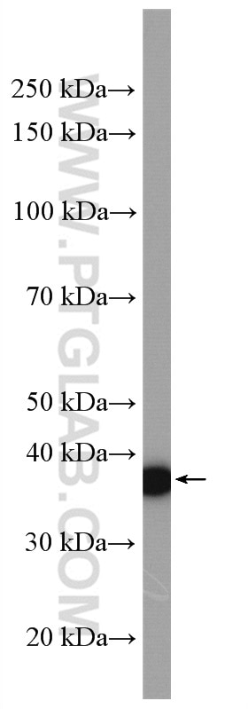 Western Blot (WB) analysis of LNCaP cells using SPON2 Polyclonal antibody (20513-1-AP)