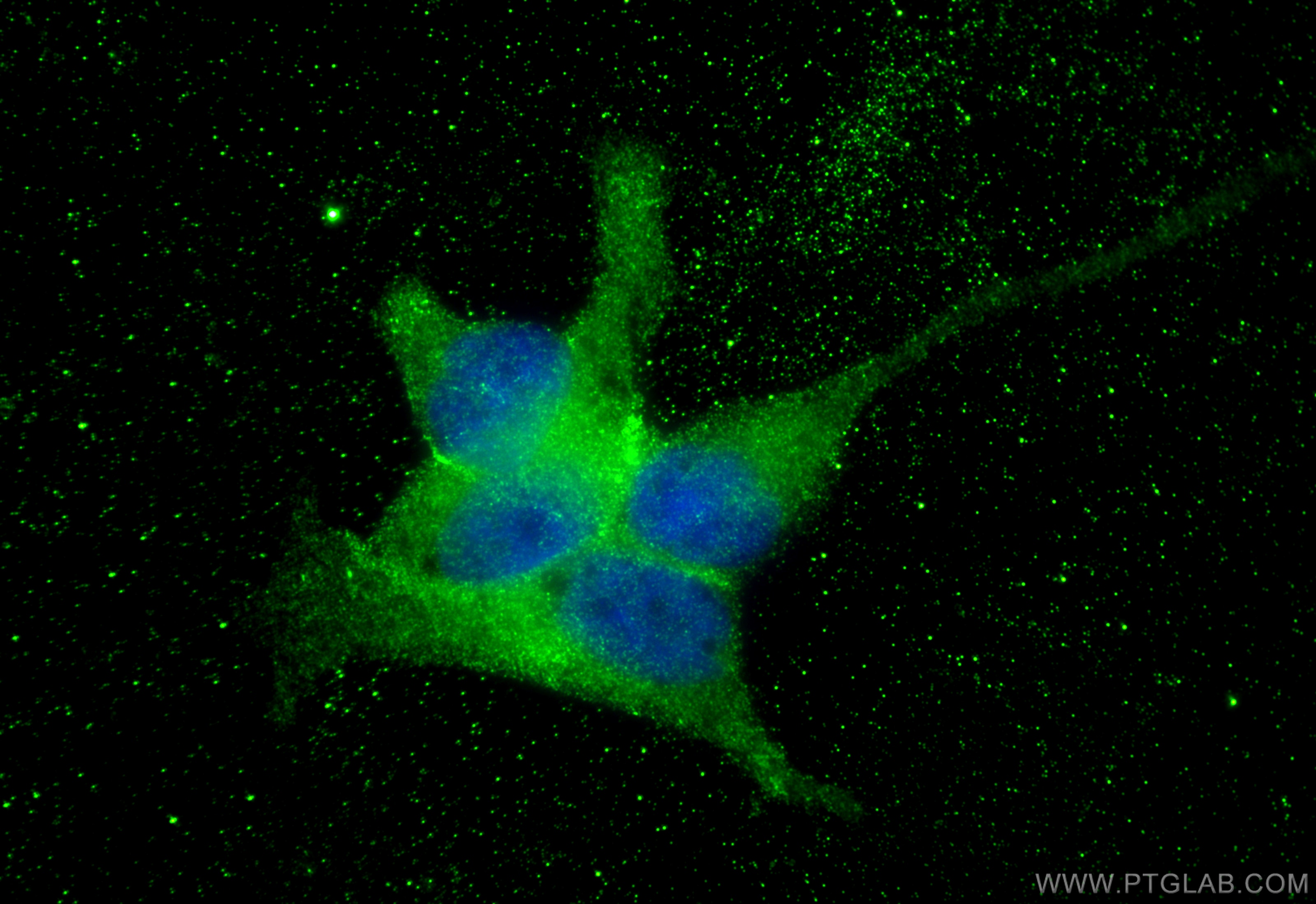Immunofluorescence (IF) / fluorescent staining of LNCaP cells using SPON2 Monoclonal antibody (66859-1-Ig)