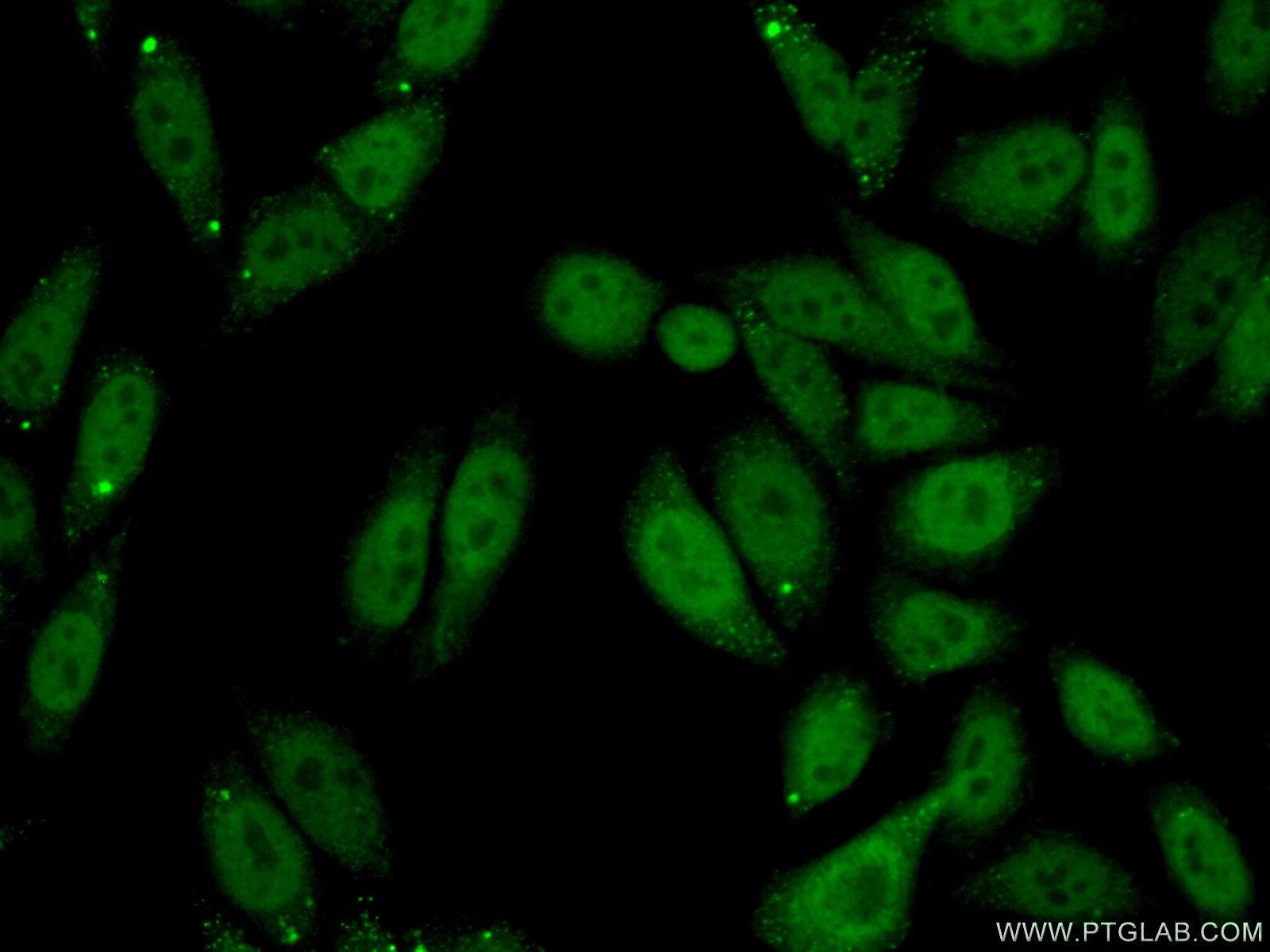 Immunofluorescence (IF) / fluorescent staining of HepG2 cells using SPOP Polyclonal antibody (16750-1-AP)