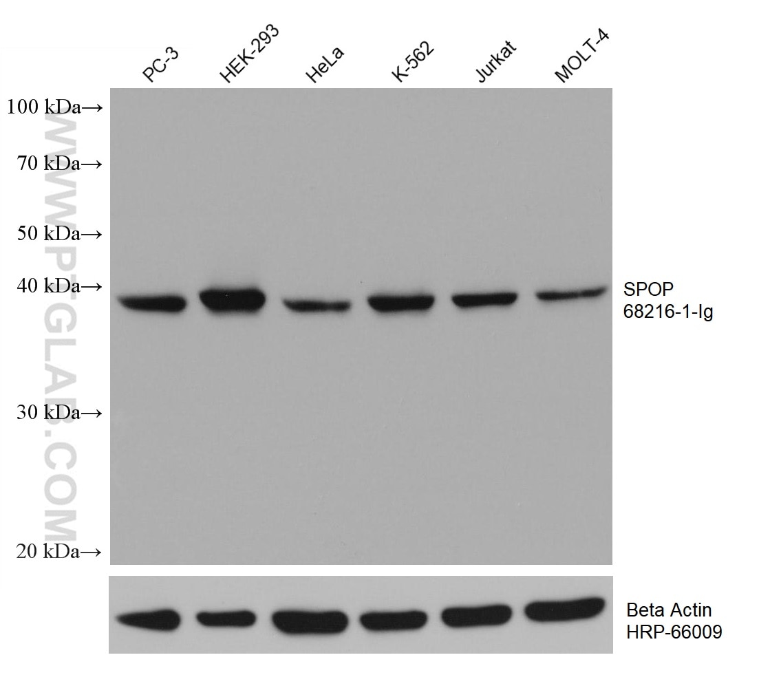 Western Blot (WB) analysis of various lysates using SPOP Monoclonal antibody (68216-1-Ig)