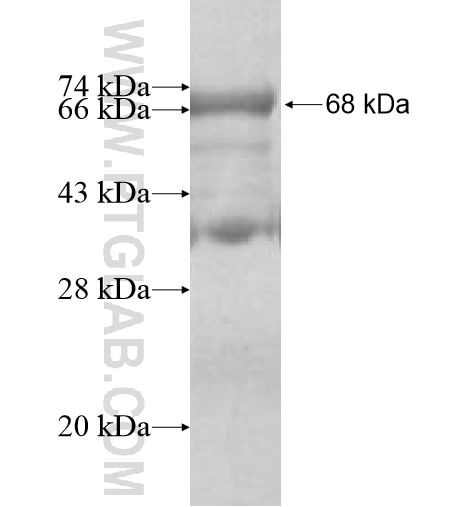 SPOP fusion protein Ag10215 SDS-PAGE