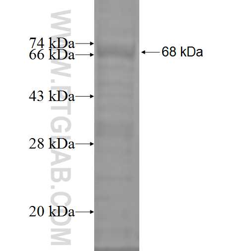 SPOP fusion protein Ag1191 SDS-PAGE