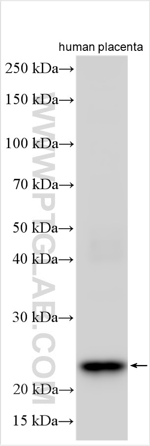 SPP2
