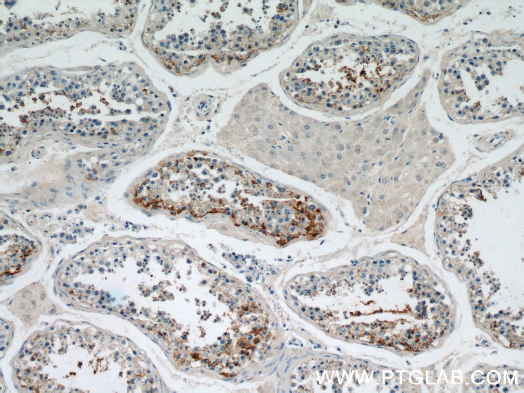 Immunohistochemistry (IHC) staining of human testis tissue using SPPL2A Polyclonal antibody (13255-1-AP)