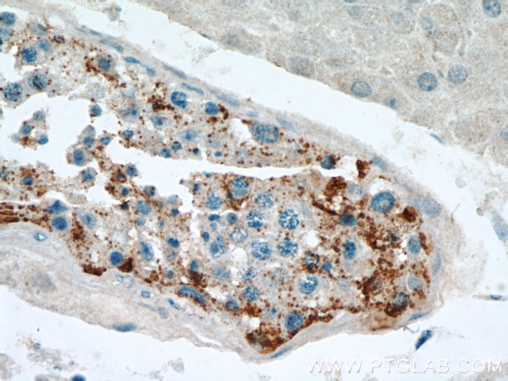 Immunohistochemistry (IHC) staining of human testis tissue using SPPL2A Polyclonal antibody (13255-1-AP)