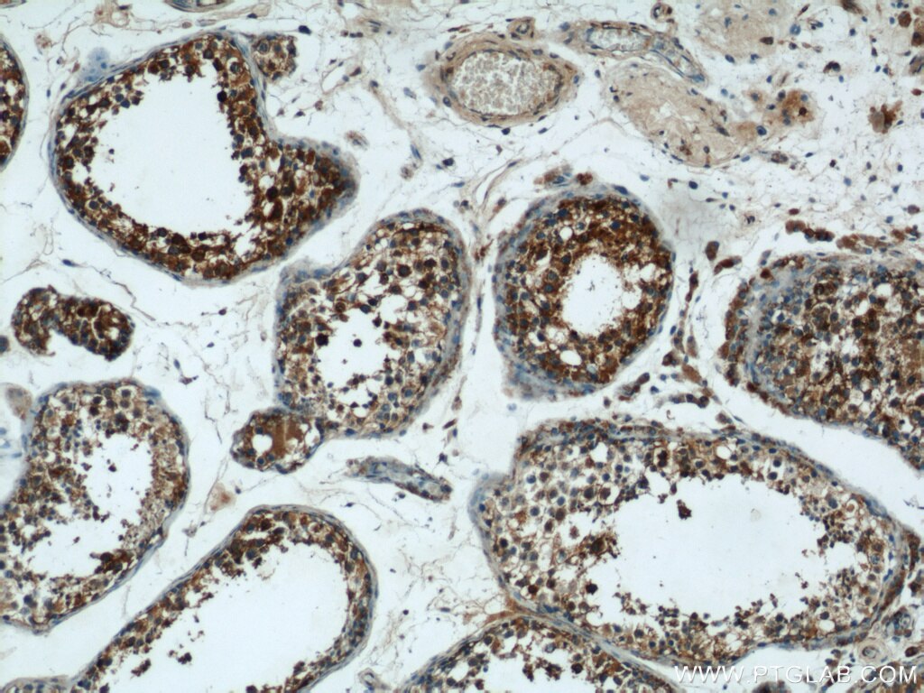 Immunohistochemistry (IHC) staining of human testis tissue using SPPL2A Polyclonal antibody (13255-1-AP)