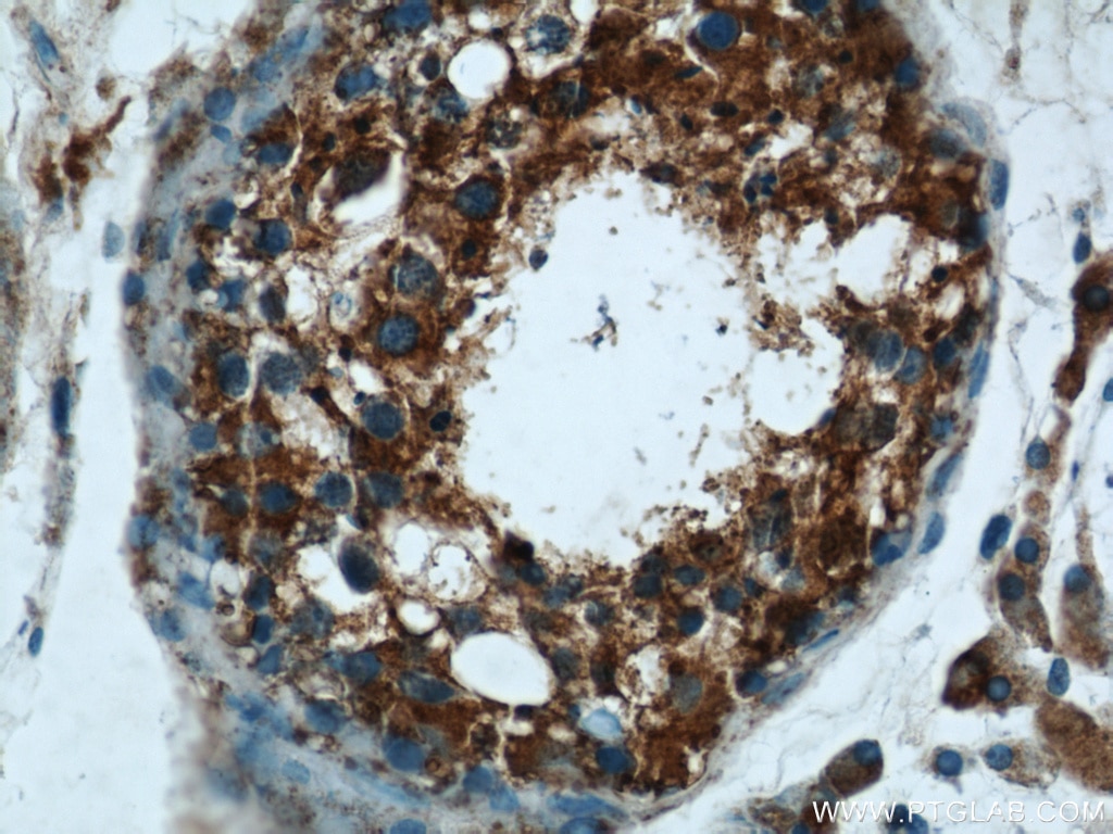 Immunohistochemistry (IHC) staining of human testis tissue using SPPL2A Polyclonal antibody (13255-1-AP)