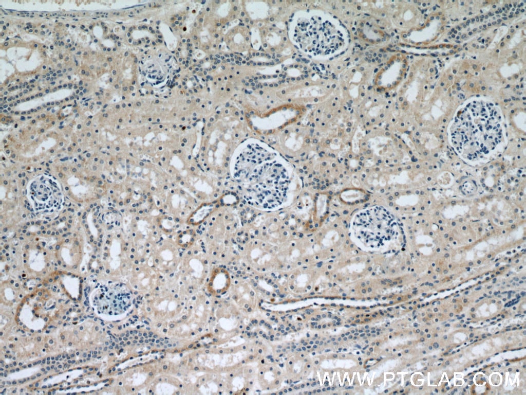 Immunohistochemistry (IHC) staining of human kidney tissue using SPPL2A Polyclonal antibody (13255-1-AP)