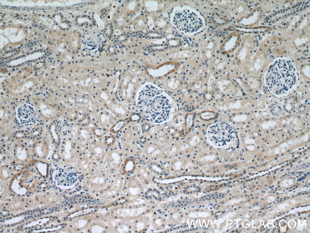 Immunohistochemistry (IHC) staining of human kidney tissue using SPPL2A Polyclonal antibody (13255-1-AP)