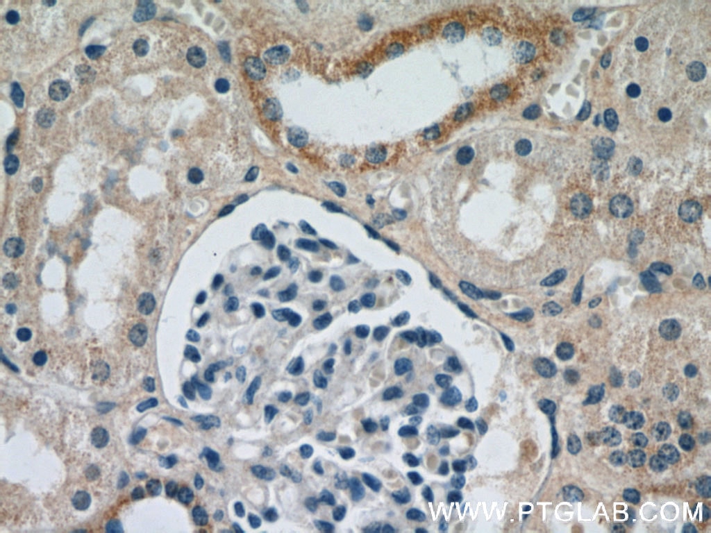 Immunohistochemistry (IHC) staining of human kidney tissue using SPPL2A Polyclonal antibody (13255-1-AP)