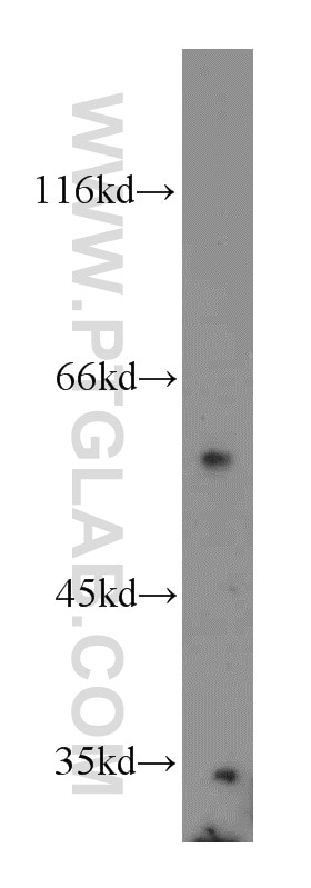 Western Blot (WB) analysis of Jurkat cells using SPPL2A Polyclonal antibody (13255-1-AP)
