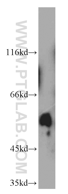 Western Blot (WB) analysis of mouse colon tissue using SPPL2A Polyclonal antibody (13255-1-AP)