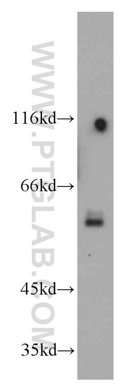 Western Blot (WB) analysis of Jurkat cells using SPPL2A Polyclonal antibody (13255-1-AP)