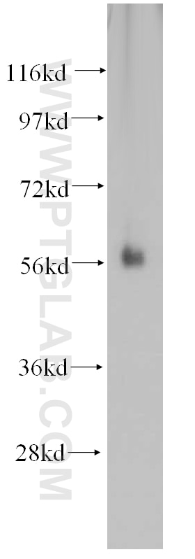 Western Blot (WB) analysis of human colon tissue using SPPL2A Polyclonal antibody (13255-1-AP)