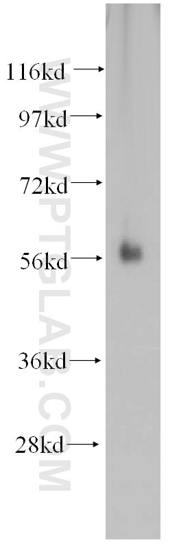 Western Blot (WB) analysis of human colon tissue using SPPL2A Polyclonal antibody (13255-1-AP)