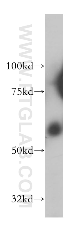 Western Blot (WB) analysis of human colon tissue using SPPL2A Polyclonal antibody (13255-1-AP)
