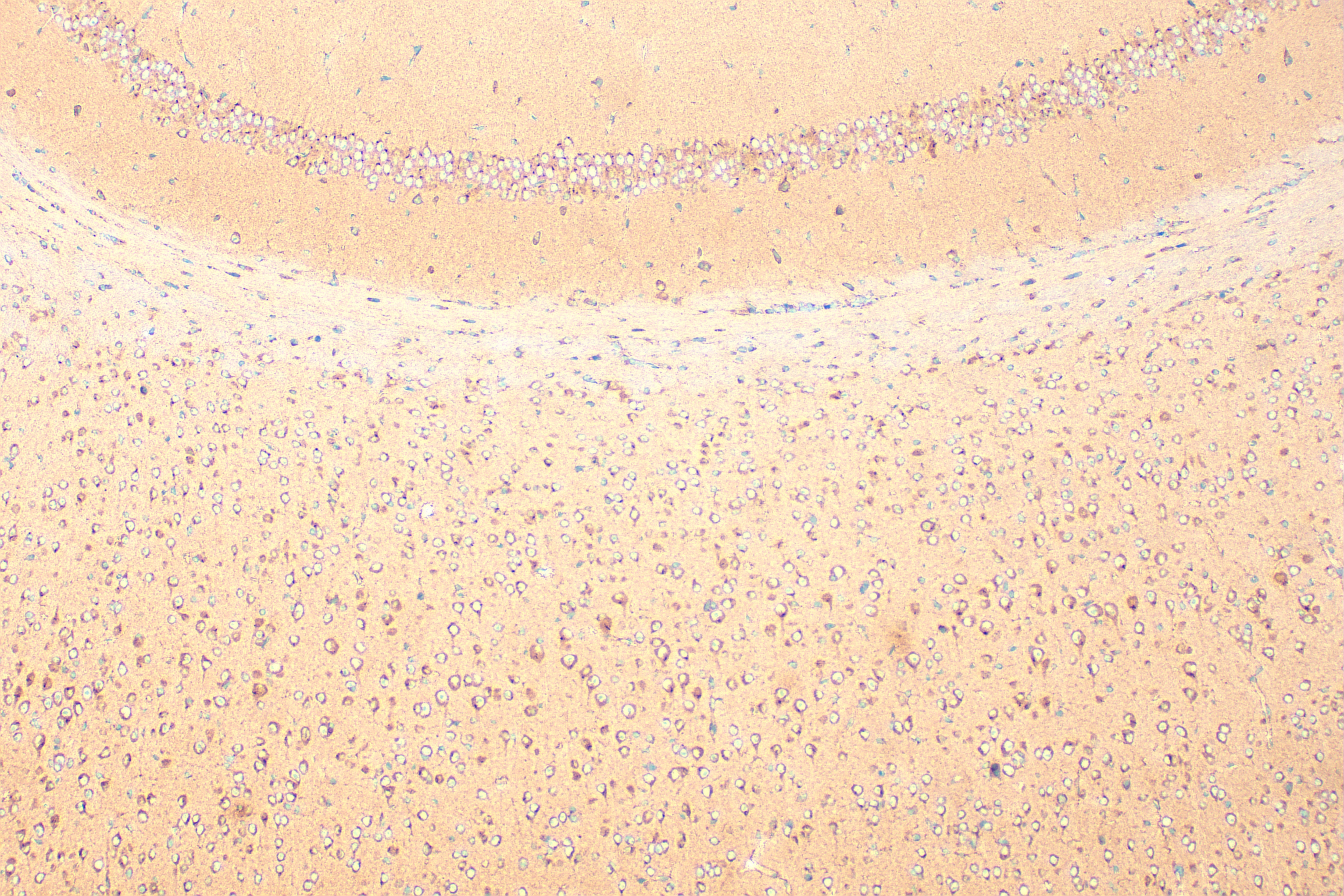 IHC staining of mouse brain using 27370-1-AP Immunohistochemistry (IHC) staining of mouse brain tissue using SPPL2B Polyclonal antibody (27370-1-AP)