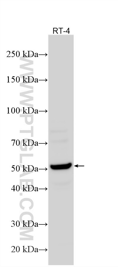 WB analysis using 27370-1-AP Western Blot (WB) analysis of various lysates using SPPL2B Polyclonal antibody (27370-1-AP)