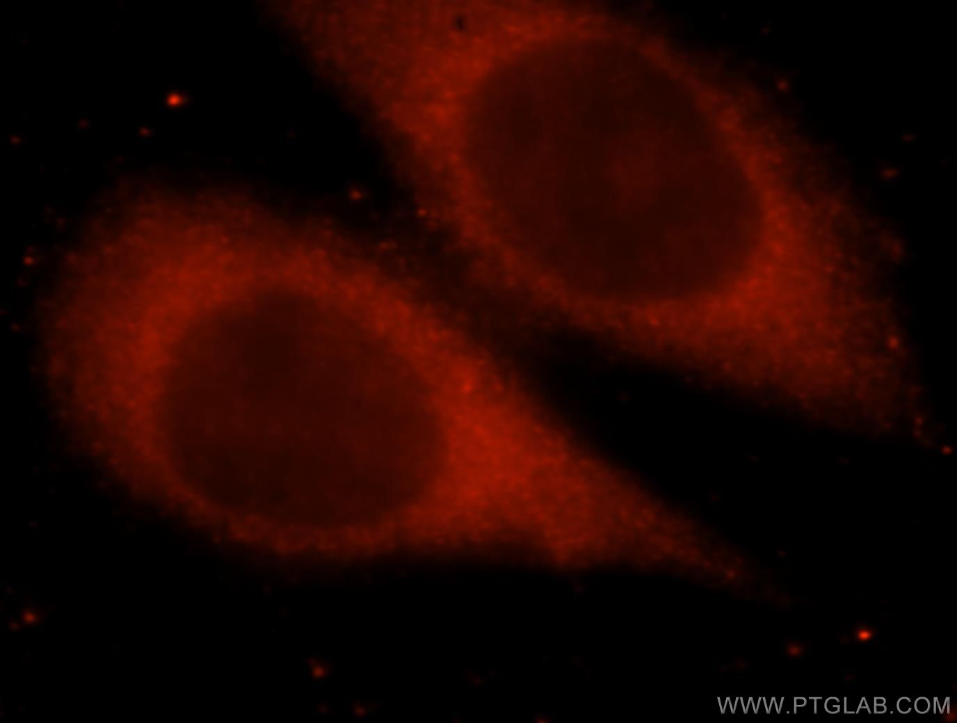 Immunofluorescence (IF) / fluorescent staining of HeLa cells using SPR Polyclonal antibody (16822-1-AP)