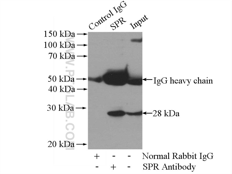 Immunoprecipitation (IP) experiment of mouse liver tissue using SPR Polyclonal antibody (16822-1-AP)