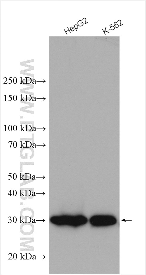 Western Blot (WB) analysis of various lysates using SPR Polyclonal antibody (16822-1-AP)