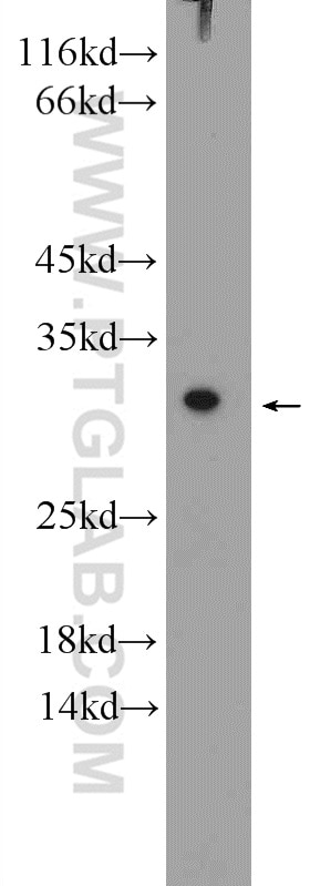 Western Blot (WB) analysis of rat heart tissue using SPR Polyclonal antibody (16822-1-AP)