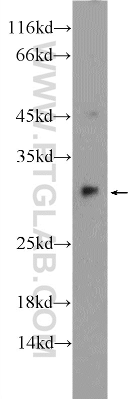 Western Blot (WB) analysis of rat liver tissue using SPR Polyclonal antibody (16822-1-AP)