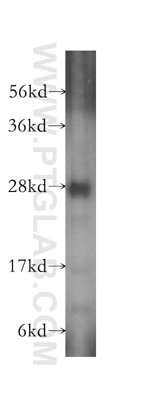 Western Blot (WB) analysis of human liver tissue using SPR Polyclonal antibody (16822-1-AP)