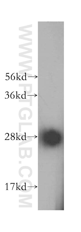 Western Blot (WB) analysis of HepG2 cells using SPR Polyclonal antibody (16822-1-AP)